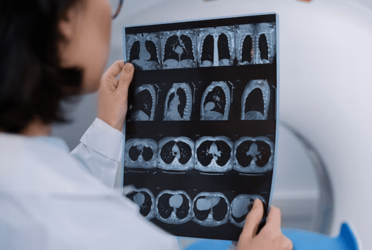 Medical Imaging and Radiology